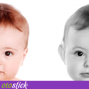Otostick естетични коректори за щръкнали уши, кутия за бебе